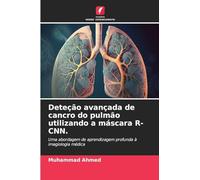 Deteção avançada de cancro do pulmão utilizando a máscara R-CNN.: Uma abordagem de aprendizagem profunda à imagiologia médica