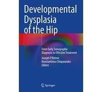 Developmental Dysplasia of the Hip: From Early Sonographic Diagnosis to Effective Treatment