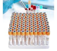 DHsdlpLU Vacuum Blood Collection Coagulation Tubes with No Additive PET Material for Venous Blood Centrifuge Use and Vacutainer Tube Set Compatibility Yellow-5ml