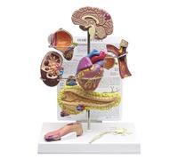 Diabetes Anatomical Model Set - Educational Human Anatomy and Physiology Model for Medical Training, Nursing Students, and Diabetes Awareness Education
