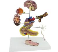 Diabetes Display Model Hypertension Model Diabetes Organ Model Brain, Eye, Heart, Kidney,Foot Models Set of 8 Professional Teaching Medical Model