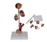 Diabetes Model Anatomical Medical Organ Removable Diabetes Model 5 Parts Human Organ Eye Ball Heart Kidney Vase Foot Human Anatomy Models For Help