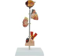 Diabetes Model Set - Anatomical Model for Human Diabetic Organs including Eyeball, Heart, Blood Vessels, Kidneys, and Feet - Educational Science Anatomy Model