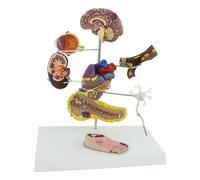 Diabetes Model Set - Human Diabetic Pathology Model with 8 Components for Doctor-Patient Communication, Includes Foot, Brain, Heart, Kidney, and Thrombosis Display