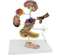 Diabetes Model Set, Human Medicine Diabetes Model, Replica for Human Anatomy and Physiology Education, Doctor-Patient Communication Medical Diabetes Model 8 Pieces