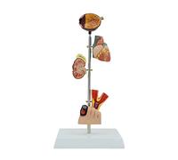 Diabetes Organ Model Eye Heart Kidney Vascular Disease Human Anatomy Science Models for Educational Training Aid