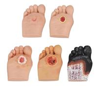 Diabetic Foot Model, Multi-dimensional Ulcer Display (Grade 1-5), 5pcs Wound Care Tool for Medical Training, Hospitals, Emergency Centers, Fixed Base Design
