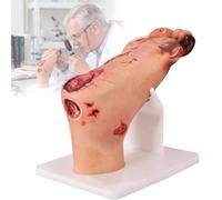 Diabetic Foot Ulcer Anatomical Model Set, Mild & Severe Stage Pathology Study Clinical Simulator, Realistic Foot Care Nursing Training Model with Purulent Lesions for Medical School(Severe)