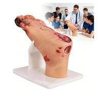 Diabetic Foot Ulcer Pathology Model, Realistic Appearance Design and Highly Simulated, Nursing Simulator with Purulent Lesions, for Wound Care Demonstrations(Mild Disease)