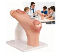 Diabetic Foot Ulcer Pathology Model, Realistic Appearance Design and Highly Simulated, Nursing Simulator with Purulent Lesions, for Wound Care Demonstrations(Severe)