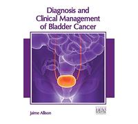 Diagnosis and Clinical Management of Bladder Cancer
