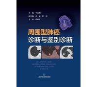 Diagnosis and Differential Diagnosis of Peripheral Lung Cancer/周围型肺癌诊断与鉴别诊断