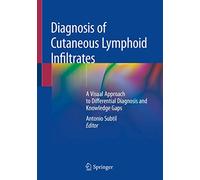 Diagnosis of Cutaneous Lymphoid Infiltrates: A Visual Approach to Differential Diagnosis and Knowledge Gaps