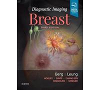 Diagnostic Imaging: Breast