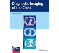 Diagnostic Imaging of the Chest