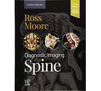 Diagnostic Imaging: Spine