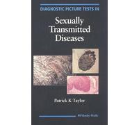 Diagnostic Picture Tests In Sexually Transmitted Diseases