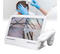 Diagnostic Scalp Analysis Skin Analyzer Machine Hair Digital Hair Scanner, Scanner, Health