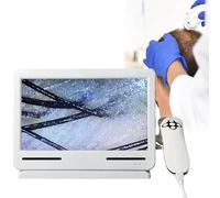 Diagnostic Scalp Analysis Skin Diagnosis Hair Analyzer Machine, Detection and Detection Tester, Lightweight and Portable, Ideal for Solving and Follicle Problems