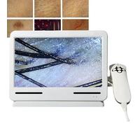 Diagnostic Scalp Analysis Skin Diagnosis Hair Analyzer Machine Microscope, for Detection and Detection, Simple Operation