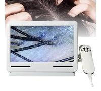 Diagnostic Scalp Analysis Skin Diagnosis Hair Analyzer Professional Microscope, Simple Operation