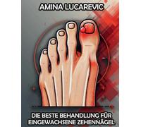 DIE BESTE BEHANDLUNG FÜR EINGEWACHSENE ZEHENNÄGEL: FÜR SPORTLER UND ANDERE, DIE SCHON EINE OPERATION WEGEN URASLAGEN NOKTENS HATTEN UND TROTZDEM KEINE LÖSUNG DAFÜR HABEN