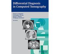 Differential Diagnosis in Computed Tomography – Thieme