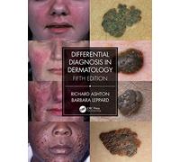 Differential Diagnosis in Dermatology