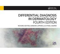 Differential Diagnosis in Dermatology