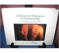Differential Diagnosis in Dermatology, Second Edition