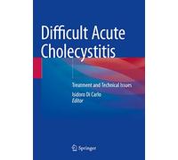 Difficult Acute Cholecystitis: Treatment and Technical Issues
