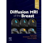 Diffusion MRI of the Breast