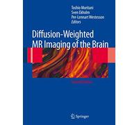 Diffusion-Weighted MR Imaging of the Brain