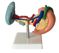 Digestive Organ Model Set - Human Pancreas, Duodenum, Spleen, Liver & Gallbladder with Pathology Features - 20cm Educational Anatomy Teaching Tool