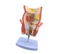 Digestive Pathology Display Aid, PVC Anatomy Teaching Model with Color Separated Detail for Classroom Study Pathology Anatomy Model Digestive Teaching Aid PVC Cutaway Display Classroom Lesson