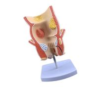 Digestive Pathology Display Aid, Rectal Pathology