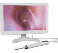 Digital Otoscope Camera, 10-Inch Screen Ear Wax Removal Tool with 55mm Lens, 3500mAh Battery, for Adults, Kids, and Pets