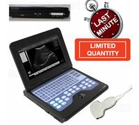 Digital Portable Notebook Laptop Ultrasound machine Scanner system CONVEX PROBE