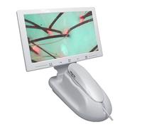 Digital Skin Diagnosis Scanner, 11 Inch Skin Diagnosis Hair Analyzer with 50X & 200X Lens and 3 Spectrum Detection, 10 Million Pixel and Support Picture Freeze Function, for Salon, Spa Center
