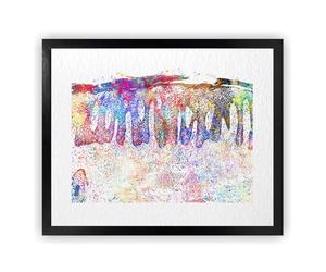 Dignovel Studios 11X14 Unframed Psoriasis Skin Epidermis Histology Dermatology Cell Clinic Medical Watercolor Art Print Poster Wall Hanging DN991