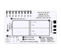 Diheohg 7 Step ECG Ruler, 7 Step Ruler for ECG/EKG Interpretation, Effective Cardiac Analysis and Measurement Tool