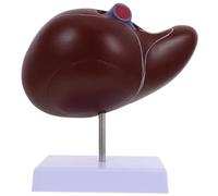 DIKACA Medical Anatomical Liver Model with Base Human Liver Display Teaching Tool for Students and Educators for Medical Learning