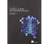 Discover Radiology: Chest X-Ray Interpretation