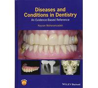 Diseases and Conditions in Dentistry: An Evidence-Based Reference
