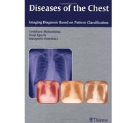 Diseases of the Chest: Imaging Diagnosis Based on Pattern Classification