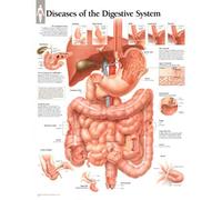 Diseases of the Digestive System Laminated Poster
