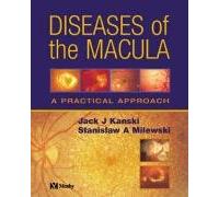 Diseases of the Macula: A Practical Approach