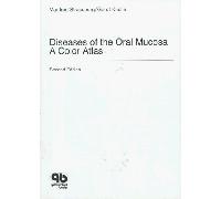 Diseases of the Oral Mucosa: A Colour Atlas