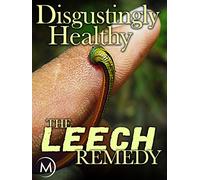 Disgustingly Healthy: The Leech Remedy