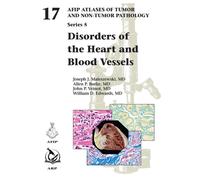 Disorders of the Heart and Blood Vessels